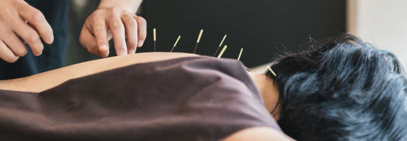 Person lying facedown with acupuncture needle along neck and spine